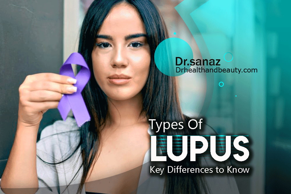 Types Of Lopus