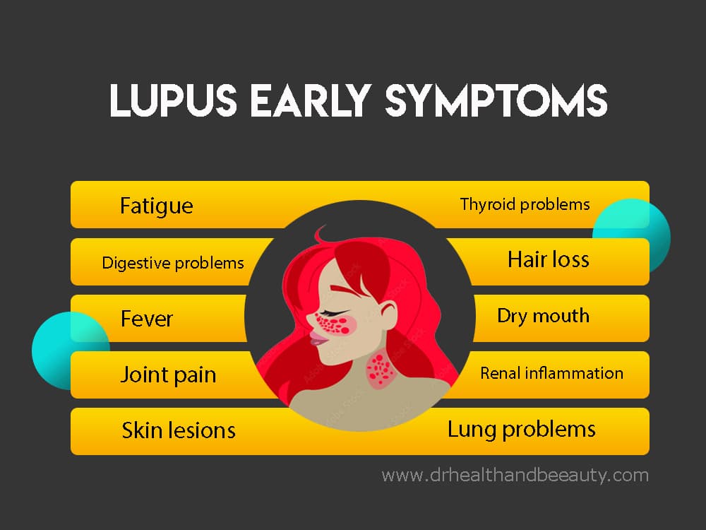 lupus-early-symptoms 1201