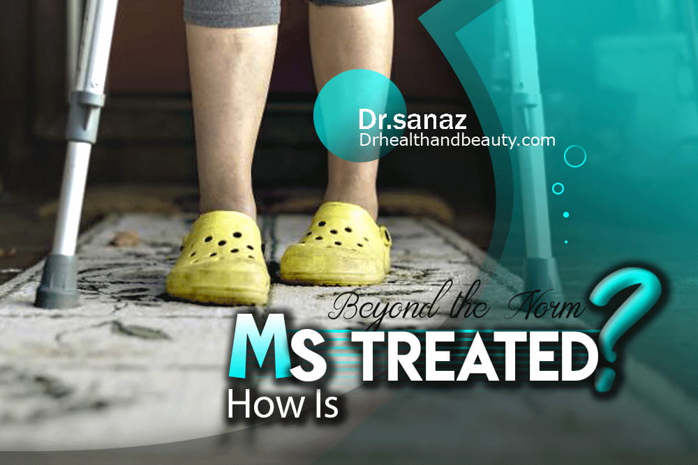 How Is MS Treated? Beyond the Norm