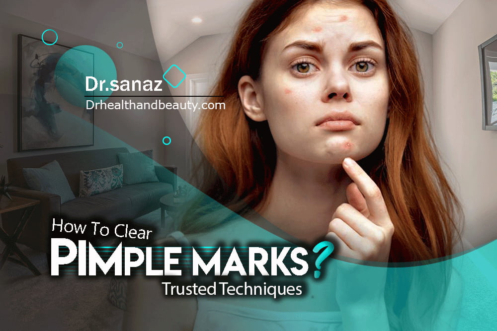 How to clear pimple marks?