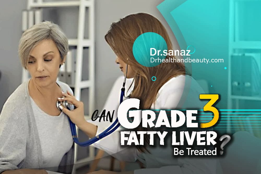 Can grade 3 fatty liver be treated?