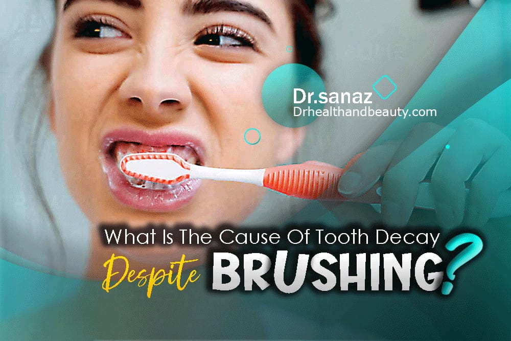 What Is The Cause Of Tooth Decay Despite Brushing?