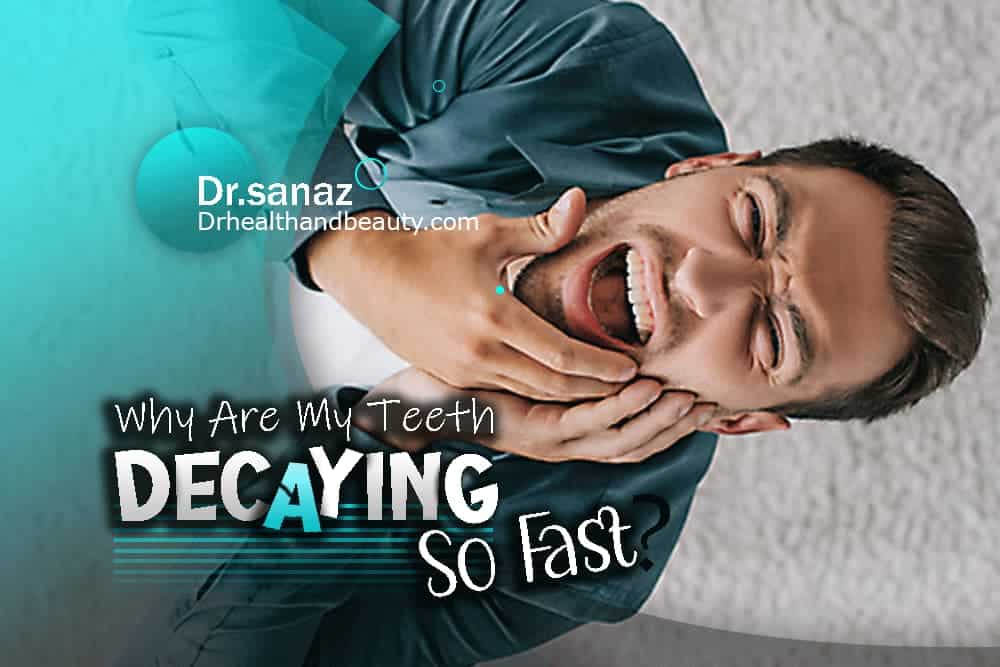 Why Are My Teeth Decaying So Fast? Healing Worries