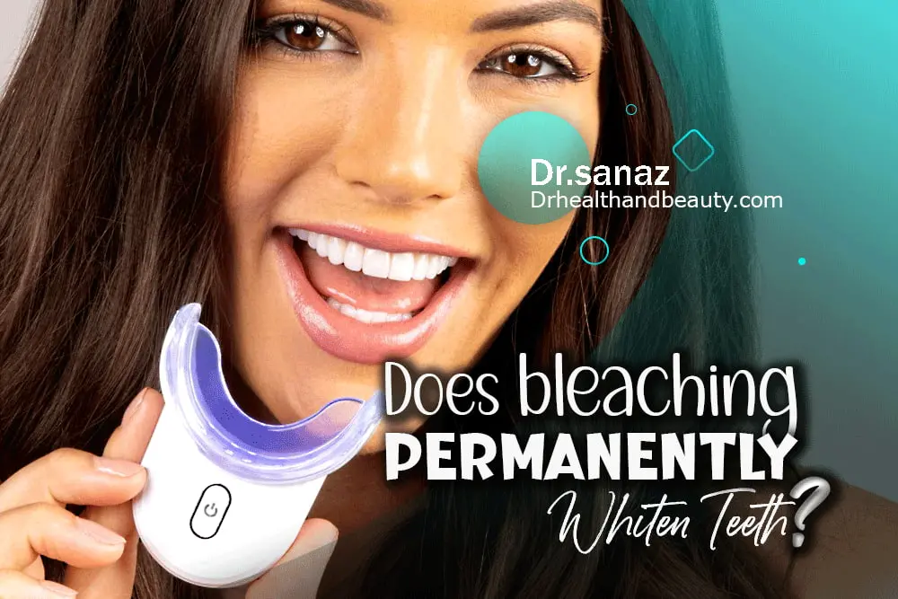 Does bleaching permanently whiten teeth?
