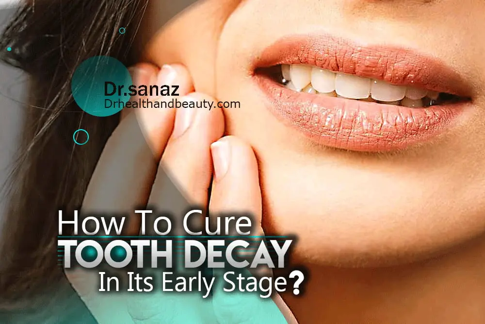 How To Cure My Tooth decay In Its Early Stage?