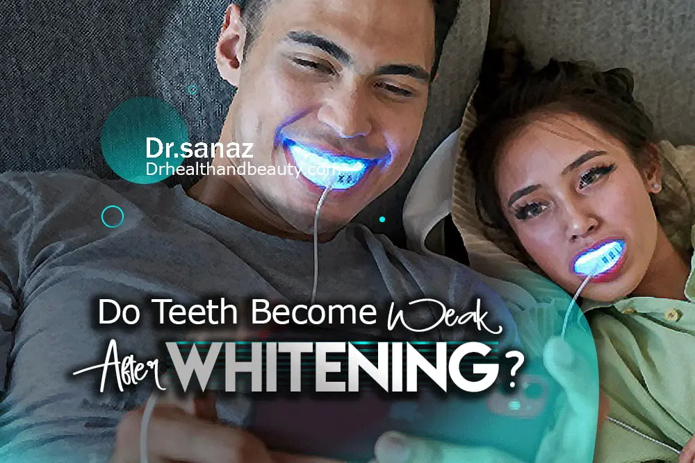 Do Teeth Become Weak After Whitening?