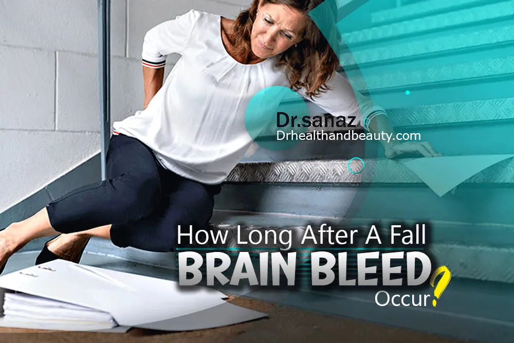 How-long-after-a-fall-can-a-brain-bleed-occur