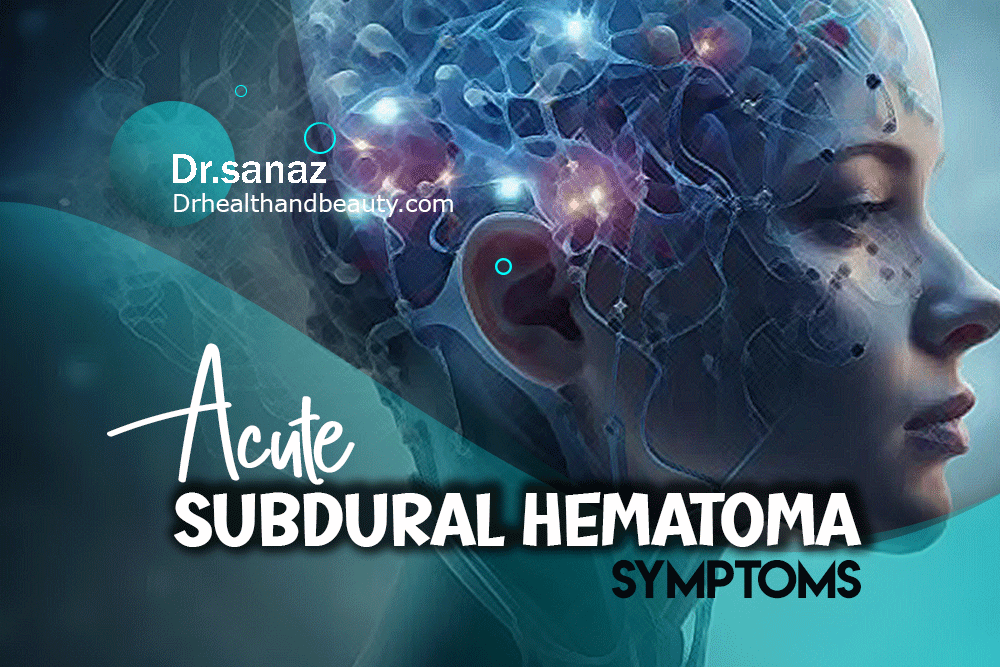 acute subdural hematoma symptoms