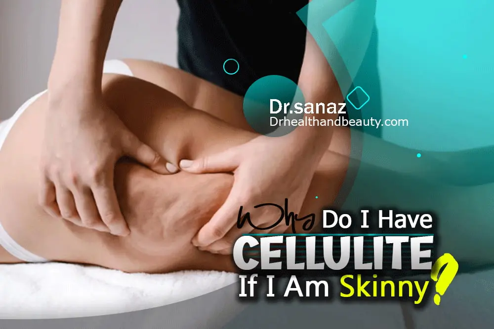 Why Do I Have Cellulite If I Am Skinny?