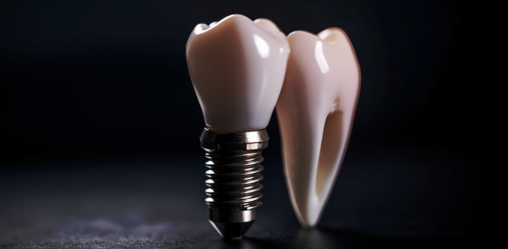 What Is The Most Painful Part Of A Dental Implant? 03