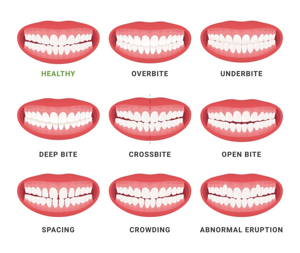 teeth disorders type