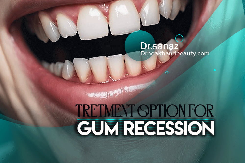 Treatment For Gum Recession: What Are Your Options?