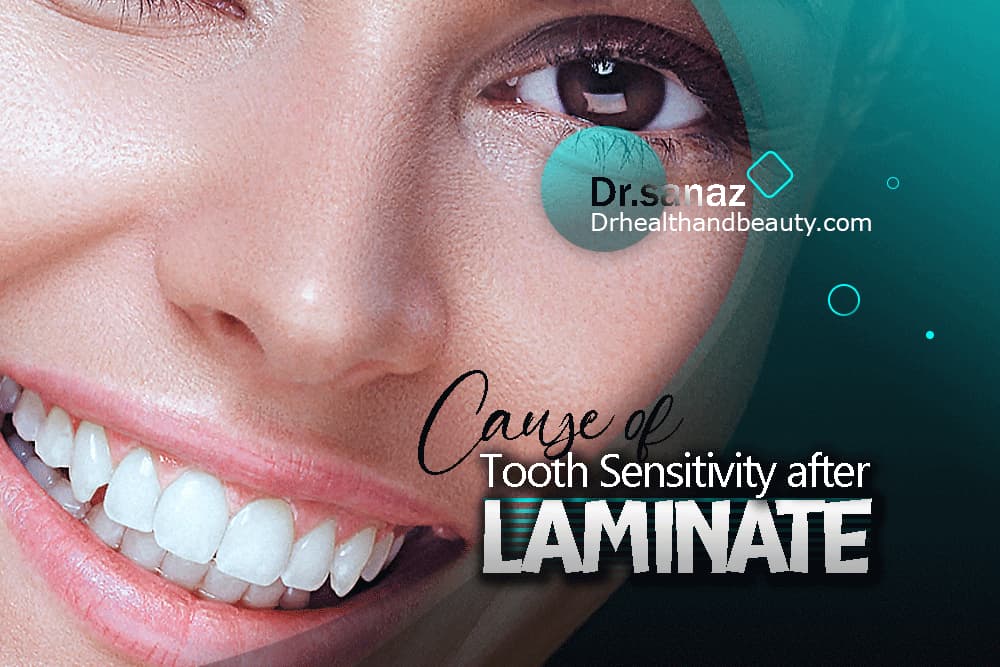 What is the cause of tooth sensitivity after laminate
