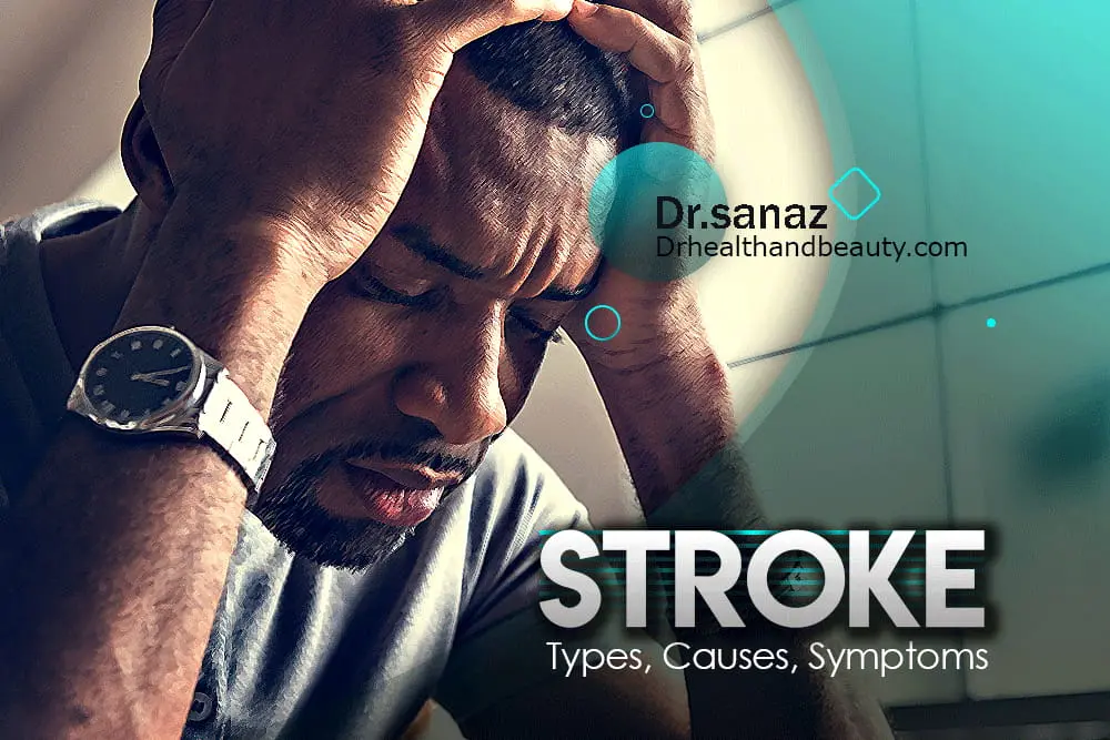 stroke--types--causes--symptoms