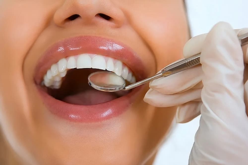 Deep Cleaning Teeth Or Dental Scaling 012