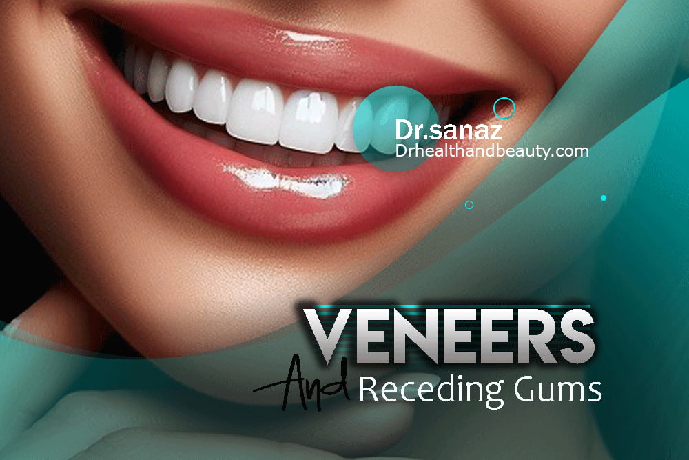 Can I get veneers with receding gums?