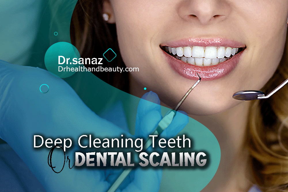 Deep Cleaning Teeth Or Dental Scaling