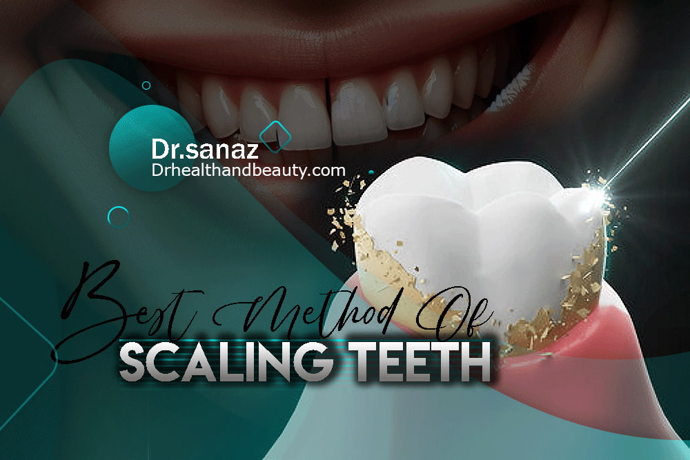 What is the best method of scaling teeth?