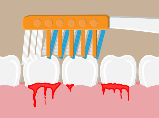 What are the disadvantages of deep cleaning teeth? 06