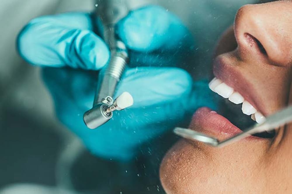 What is the best method of scaling teeth? 12543