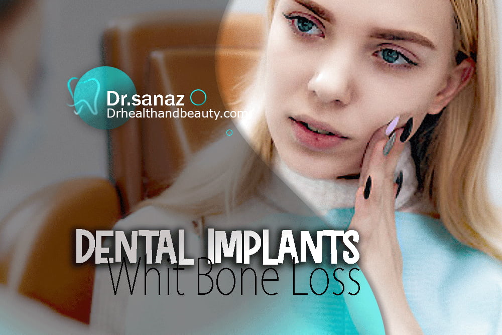 Dental-Implants-With-Severe-Bone-Loss