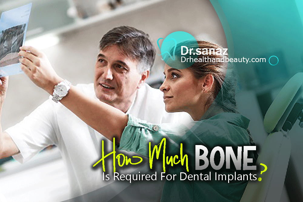 How Much Bone Is Required For Dental Implants?