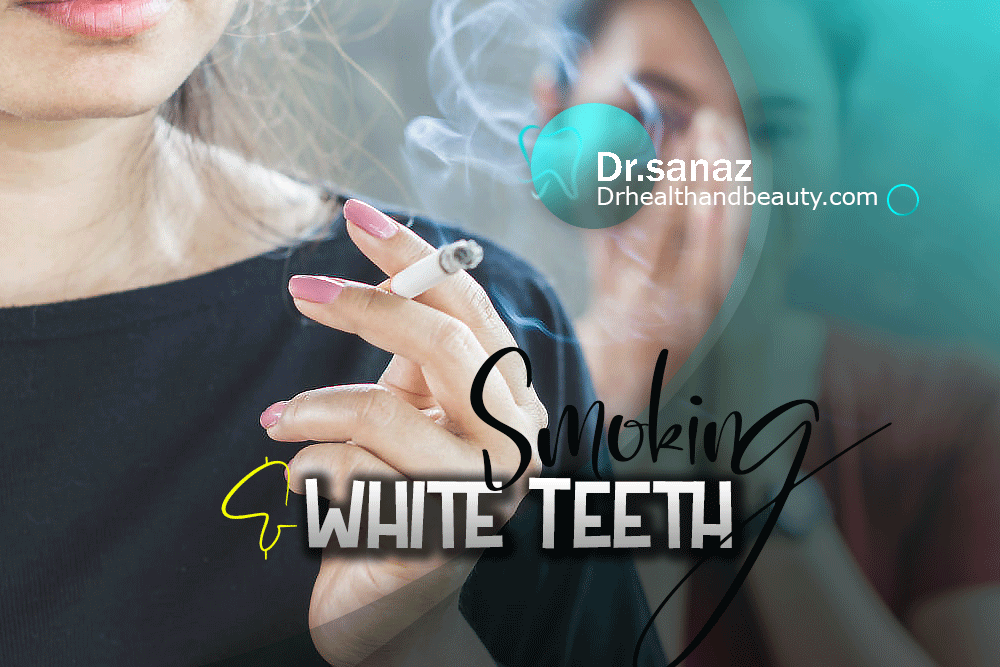 How Can I Keep My Teeth White If I Smoke?