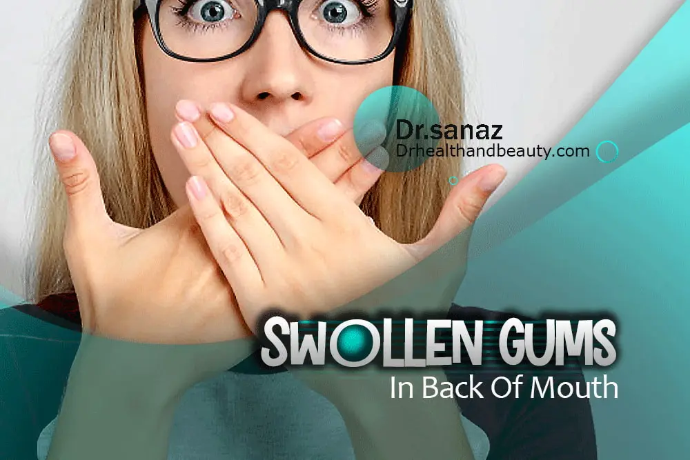 Swollen-Gums-In-Back-Of-Mouth