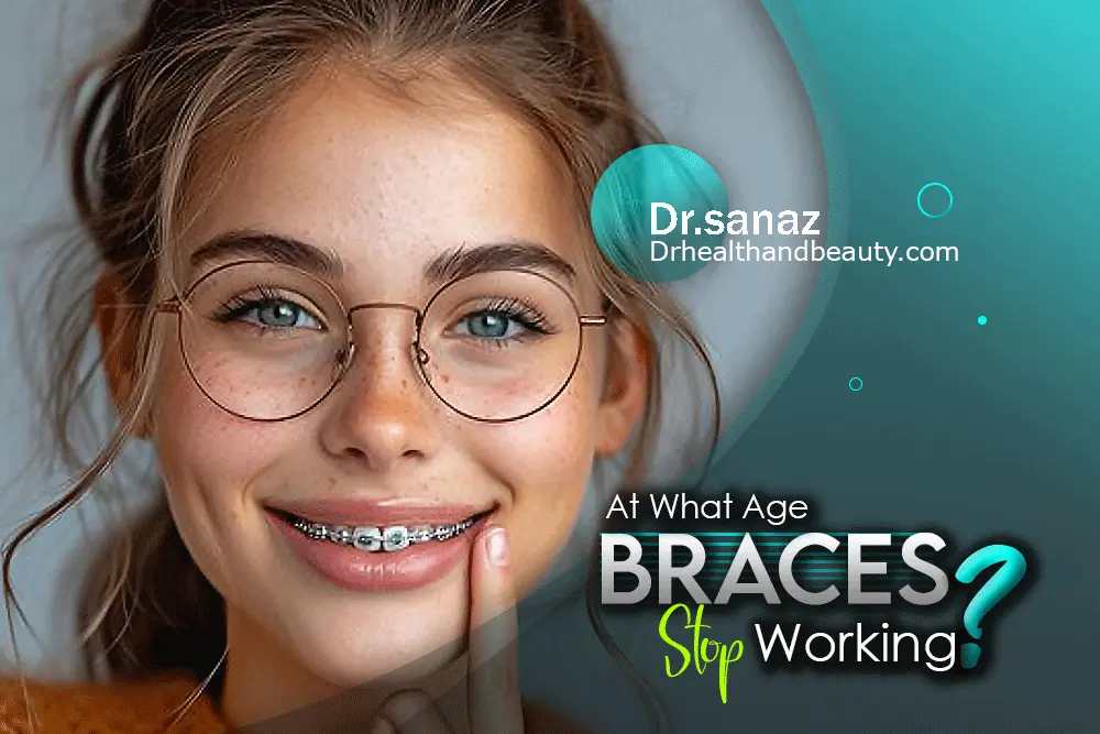 At-What-Age-Do-Braces-Stop-Working