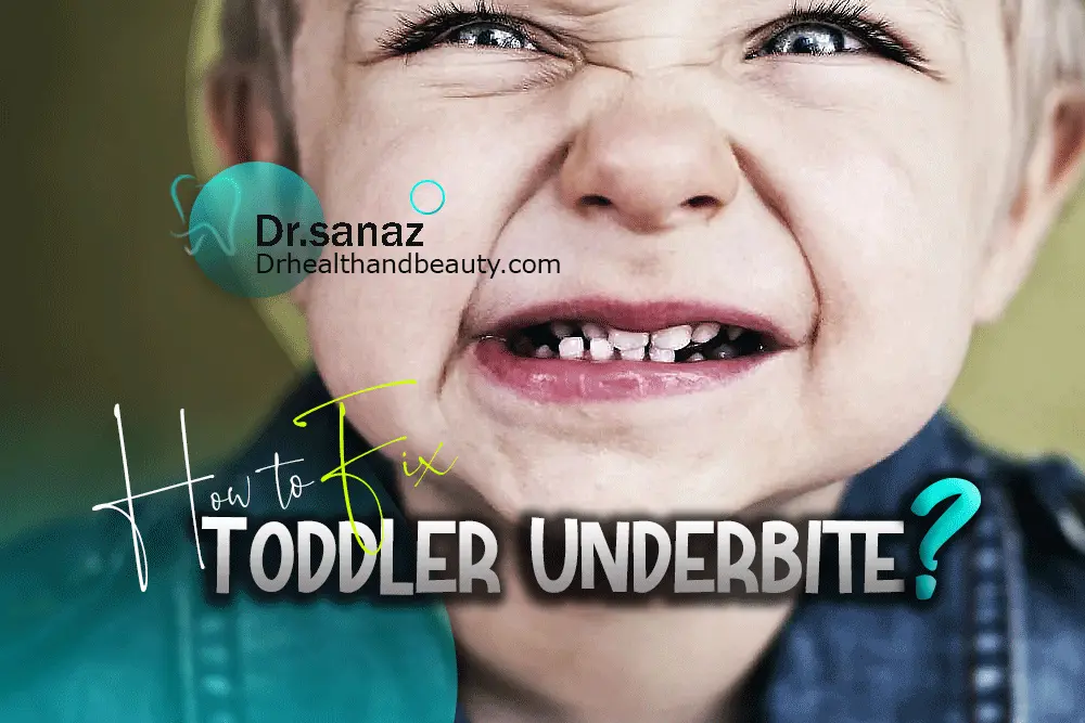 How-to-Fix-Toddler-Underbite