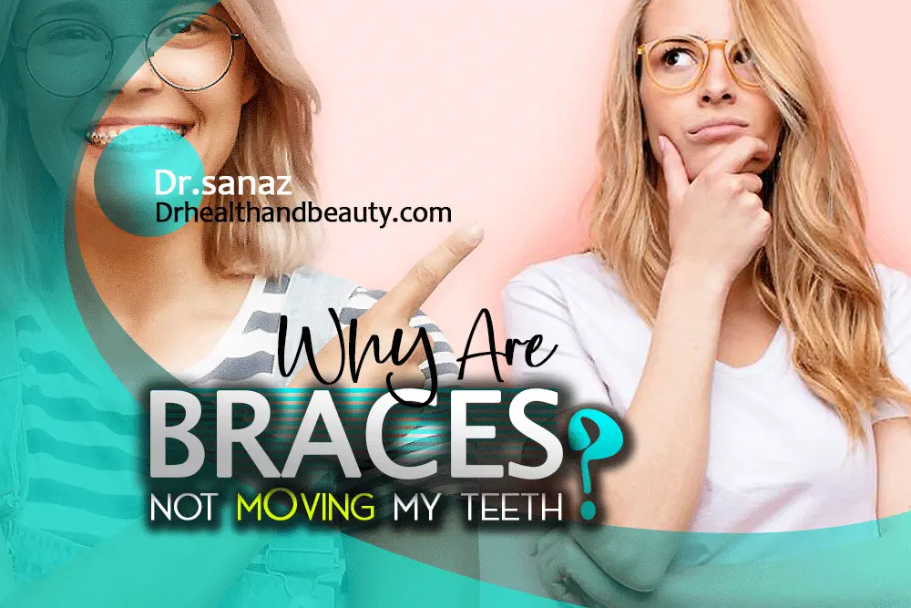 Why Are Braces Not Moving My Teeth?